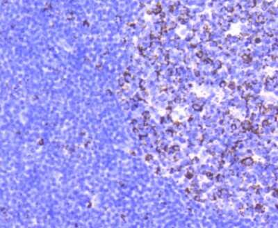 Immunohistochemistry-Paraffin: Glutaminase Antibody (SN68-09) [NBP2-67683] - Analysis of paraffin-embedded human tonsil tissue using anti-Glutaminase antibody. Counter stained with hematoxylin.