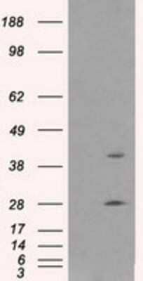 Western Blot: Glutamine Synthetase Antibody (1F4) [NBP2-02125] - HEK293T cells were transfected with the pCMV6-ENTRY control (Left lane) or pCMV6-ENTRY Glutamine Synthetase (Right lane) cDNA for 48 hrs and lysed. Equivalent amounts of cell lysates (5 ug per lane) were separated by SDS-PAGE and immunoblotted with anti-Glutamine Synthetase.