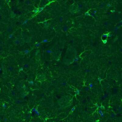 Immunohistochemistry: Glutamine Synthetase Antibody (3013) [NBP2-46645] - Staining of rat striatum shows moderate immunoreactivity in a subset of astrocytes.