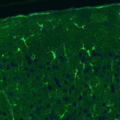 Immunohistochemistry: Glutamine Synthetase Antibody (3013) [NBP2-46645] - Staining of rat cerebral cortex shows positivity in a subset of astrocytes.