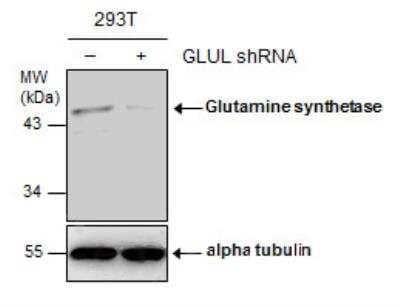 Western Blot: Glutamine Synthetase Antibody (7711) [NBP2-43826] - Non-transfected (-) and transfected (+) 293T whole cell extracts (30 ug) were separated by 10% SDS-PAGE, and the membrane was blotted with Glutamine synthetase antibody (7711) diluted at 1:500.