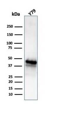 Western Blot: Glutamine Synthetase Antibody (GLUL/6604) [NBP3-13929] - Western blot analysis of Y79 cell lysate using Glutamine Synthetase antibody (GLUL/6604).