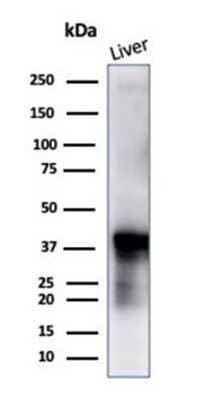 Western Blot: Glutamine Synthetase Antibody (GLUL/6604) [NBP3-13929] - Western blot analysis of human liver tissue using Glutamine Synthetase antibody (GLUL/6604).