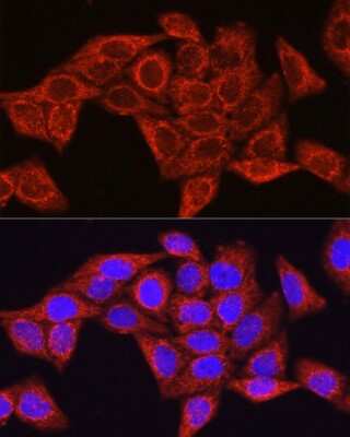 Immunocytochemistry/Immunofluorescence: Glutamine Synthetase Antibody [NBP3-03471] - Immunofluorescence analysis of HeLa cells using [KO Validated] Glutamine Synthetase Rabbit pAb (NBP3-03471) at dilution of 1:100 (40x lens). Blue: DAPI for nuclear staining.