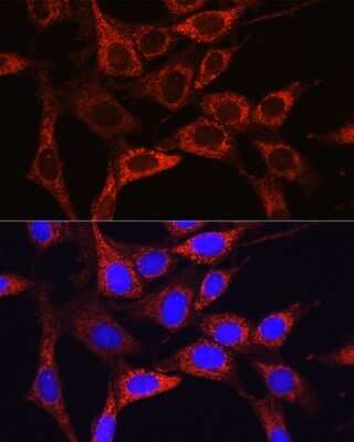 Immunocytochemistry/Immunofluorescence: Glutamine Synthetase Antibody [NBP3-03471] - Immunofluorescence analysis of NIH/3T3 cells using [KO Validated] Glutamine Synthetase Rabbit pAb (NBP3-03471) at dilution of 1:100 (40x lens). Blue: DAPI for nuclear staining.