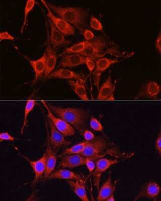 <b>Genetic Strategies Validation. </b>Immunocytochemistry/Immunofluorescence: Glutamine Synthetase Antibody [NBP3-03471] - Immunofluorescence analysis of PC-12 cells using [KO Validated] Glutamine Synthetase Rabbit pAb (NBP3-03471) at dilution of 1:100 (40x lens). Blue: DAPI for nuclear staining.