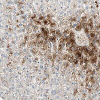 Immunohistochemistry-Paraffin: Glutamine Synthetase Antibody [NBP1-89767] - Staining of human liver shows strong cytoplasmic positivity in hepatocytes.