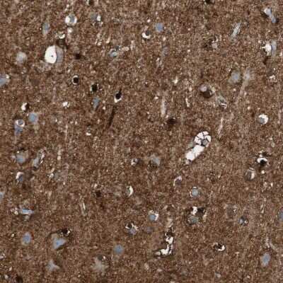 Immunohistochemistry-Paraffin: Glutamine Synthetase Antibody [NBP1-89768] - Staining of human cerebral cortex shows strong cytoplasmic positivity in glial cells.