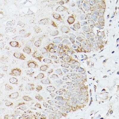 Immunohistochemistry-Paraffin: Glutamine Synthetase Antibody [NBP3-03471] - Immunohistochemistry of paraffin-embedded human esophageal using [KO Validated] Glutamine Synthetase Rabbit pAb (NBP3-03471) at dilution of 1:150 (40x lens). Perform high pressure antigen retrieval with 10 mM citrate buffer pH 6.0 before commencing with IHC staining protocol.