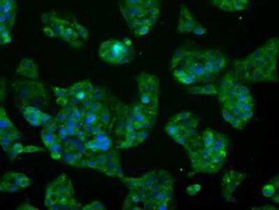 Immunocytochemistry/Immunofluorescence: Glutamine Synthetase Antibody (OTI1F4) - Azide and BSA Free [NBP2-70834] - Staining of HepG2 cells using anti-Glutamine Synthetase mouse monoclonal antibody.