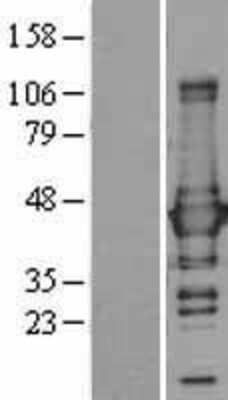 Western Blot: Glutamine Synthetase Overexpression Lysate (Adult Normal) [NBL1-11130] Left-Empty vector transfected control cell lysate (HEK293 cell lysate); Right -Over-expression Lysate for Glutamine Synthetase.