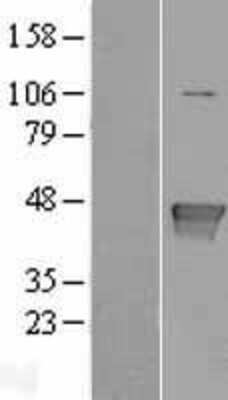 Western Blot: Glutamine Synthetase Overexpression Lysate (Adult Normal) [NBL1-11132] Left-Empty vector transfected control cell lysate (HEK293 cell lysate); Right -Over-expression Lysate for Glutamine Synthetase.