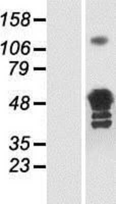 Western Blot: Glutamine Synthetase Overexpression Lysate (Adult Normal) [NBP2-11602] Left-Empty vector transfected control cell lysate (HEK293 cell lysate); Right -Over-expression Lysate for Glutamine Synthetase.