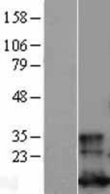 Western Blot: Glutaredoxin 1 Overexpression Lysate (Adult Normal) [NBL1-11124] Left-Empty vector transfected control cell lysate (HEK293 cell lysate); Right -Over-expression Lysate for Glutaredoxin 1.