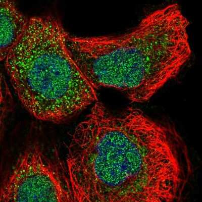 Immunocytochemistry/Immunofluorescence: Glutaredoxin 2 Antibody [NBP2-58192] - Staining of human cell line A-431 shows localization to nucleus & vesicles.