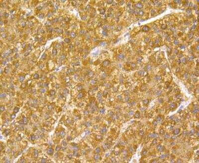 Immunohistochemistry: Glutathione Peroxidase 1/GPX1 Antibody (A6-C0-B9) [NBP2-76857] - Immunohistochemical analysis of paraffin-embedded human liver tissue using anti- Glutathione Peroxidase 1 antibody. Counter stained with hematoxylin.