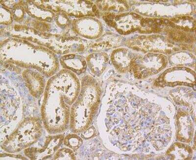 Immunohistochemistry: Glutathione Peroxidase 1/GPX1 Antibody (A6-C0-B9) [NBP2-76857] - Immunohistochemical analysis of paraffin-embedded human kidney tissue using anti- Glutathione Peroxidase 1 antibody. Counter stained with hematoxylin.