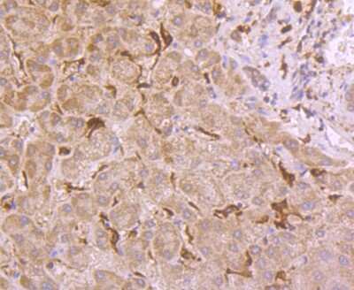 Immunohistochemistry-Paraffin: Glutathione Peroxidase 1/GPX1 Antibody (JF0944) [NBP2-66874] - Analysis of paraffin-embedded human liver tissue using anti-Glutathione Peroxidase 1 antibody. Counter stained with hematoxylin.