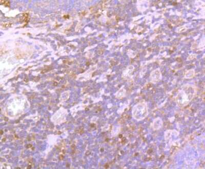 Immunohistochemistry-Paraffin: Glutathione Peroxidase 1/GPX1 Antibody (JF0944) [NBP2-66874] - Analysis of paraffin-embedded human tonsil tissue using anti-Glutathione Peroxidase 1 antibody. Counter stained with hematoxylin.