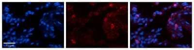 Immunohistochemistry-Paraffin: Glutathione Peroxidase 3/GPX3 Antibody [NBP2-82233] - Rabbit Anti-GPX3 Antibody. Formalin Fixed Paraffin Embedded Tissue: Human Lung Tissue. Observed Staining: Membrane and cytoplasmic in alveolar type I & II cells. Primary Antibody Concentration: 1:100. Other Working Concentrations: 1/600. Secondary Antibod