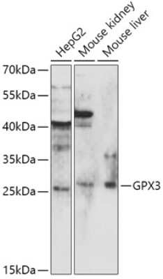 Western Blot: Glutathione Peroxidase 3/GPX3 Antibody [NBP3-03845] - Analysis of extracts of various cell lines, using Glutathione Peroxidase 3/GPx3 antibody at 1:1000 dilution. Secondary antibody: HRP Goat Anti-Rabbit IgG (H+L) at 1:10000 dilution. Lysates/proteins: 25ug per lane. Blocking buffer: 3% nonfat dry milk in TBST.