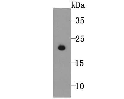 Western Blot: Glutathione Peroxidase 5 Antibody (5A1) [NBP2-75512] - Analysis of GPX5 on human sperm tissue lysate using anti-GPX5 antibody at 1/5,000 dilution.