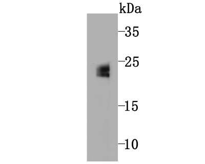 Western Blot: Glutathione Peroxidase 5 Antibody (5A1) [NBP2-75512] - Analysis of GPX5 on mouse testis tissue lysate using anti-GPX5 antibody at 1/500 dilution.