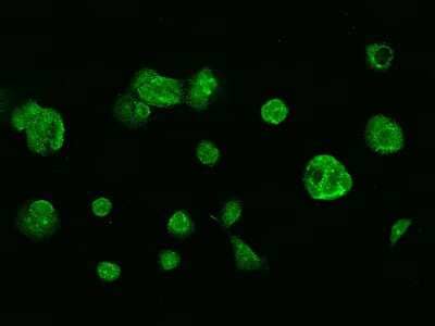 Immunocytochemistry/Immunofluorescence: Glutathione Reductase Antibody [NBP2-99476] - Immunofluorescence staining of Glutathione Reductase in MCF7 cells. Cells were fixed with 4% PFA, permeabilzed with 0.1% Triton X-100 in PBS, blocked with 10% serum, and incubated with rabbit anti-human Glutathione Reductase polyclonal antibody (dilution ratio 1:1000) at 4C overnight. Then cells were stained with the Alexa Fluor(R)488-conjugated Goat Anti-rabbit IgG Secondary antibody (green). Positive staining was localized to Cytoplasm.