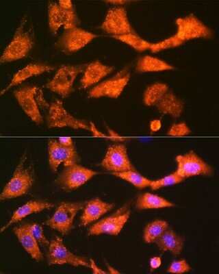 Immunocytochemistry/Immunofluorescence: Glutathione S Transferase kappa 1 Antibody (7J5B3) [NBP3-16857] - Immunofluorescence analysis of NIH-3T3 cells using Glutathione S Transferase kappa 1 Rabbit mAb (NBP3-16857) at dilution of 1:100 (40x lens). Blue: DAPI for nuclear staining.