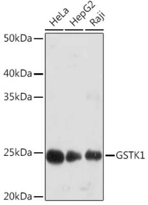 Western Blot: Glutathione S Transferase kappa 1 Antibody (7J5B3) [NBP3-16857] - Western blot analysis of extracts of various cell lines, using Glutathione S Transferase kappa 1 Rabbit mAb (NBP3-16857) at 1:1000 dilution. Secondary antibody: HRP Goat Anti-Rabbit IgG (H+L) at 1:10000 dilution. Lysates/proteins: 25ug per lane. Blocking buffer: 3% nonfat dry milk in TBST. Detection: ECL Basic Kit. Exposure time: 90s.