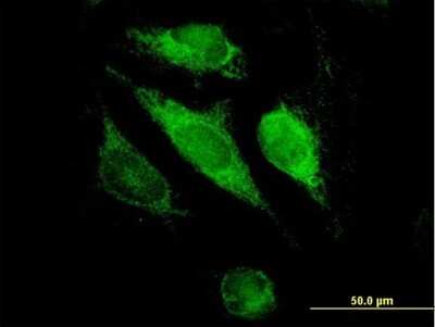 Immunocytochemistry/Immunofluorescence: Glutathione S Transferase kappa 1 Antibody [H00373156-B01P] - Analysis of purified antibody to GSTK1 on HeLa cell. (antibody concentration 10 ug/ml)