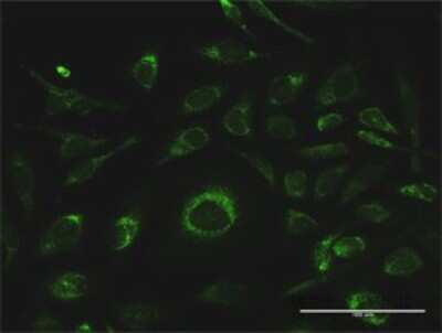 Immunocytochemistry/Immunofluorescence: Glutathione S Transferase kappa 1 Antibody [H00373156-D01P] - Analysis of antibody to GSTK1 on HeLa cell. Antibody concentration 10 ug/ml.