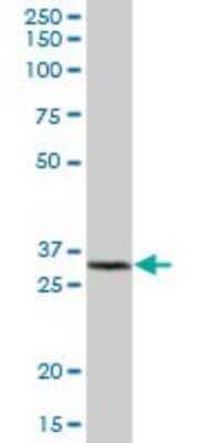 Western Blot: Glutathione S Transferase kappa 1 Antibody [H00373156-B01P] - Analysis of GSTK1 expression in human liver.