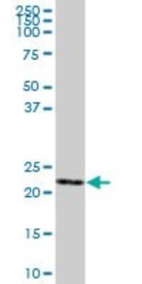 Western Blot: Glutathione S Transferase kappa 1 Antibody [H00373156-B02P] - Analysis of GSTK1 expression in human liver.