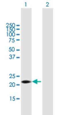 Western Blot: Glutathione S Transferase kappa 1 Antibody [H00373156-B02P] - Analysis of GSTK1 expression in transfected 293T cell line by GSTK1 polyclonal antibody.  Lane 1: GSTK1 transfected lysate(24.86 KDa). Lane 2: Non-transfected lysate.
