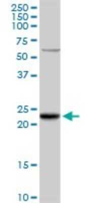 Western Blot: Glutathione S Transferase kappa 1 Antibody [H00373156-D01P] - Analysis of GSTK1 expression in human liver.