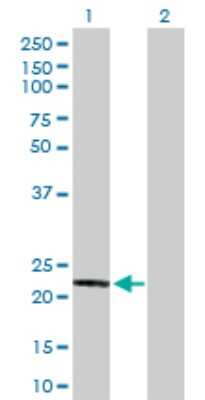 Western Blot: Glutathione S Transferase kappa 1 Antibody [H00373156-D01P] - Analysis of GSTK1 expression in transfected 293T cell line by GSTK1 polyclonal antibody.Lane 1: GSTK1 transfected lysate(25.50 KDa).Lane 2: Non-transfected lysate.