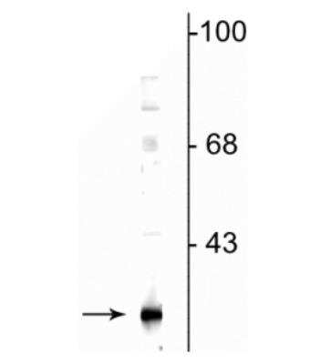 Western Blot: Glutathione S Transferase kappa 1 Antibody [NBP2-60791] - Western blot of mouse adipose tissue lysate showing specificimmunolabeling of the ~25 kDa DsbA-L protein.