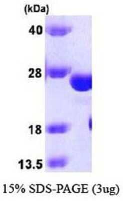 SDS-Page: Recombinant Human Glutathione S Transferase kappa 1 Protein [NBP1-37083] -  GSTK1, 25.5 kDa (226aa), confirmed by MALDI-TOF with a purity of 90% by SDS - PAGE