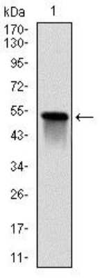Western Blot: Glutathione S-Transferase mu 1/GSTM1 Antibody (1H4A4) [NBP2-22185] - Western blot analysis using GSTM1 mAb against human GSTM1 (AA: 23-181) recombinant protein. (Expected MW is 25.7 kDa)
