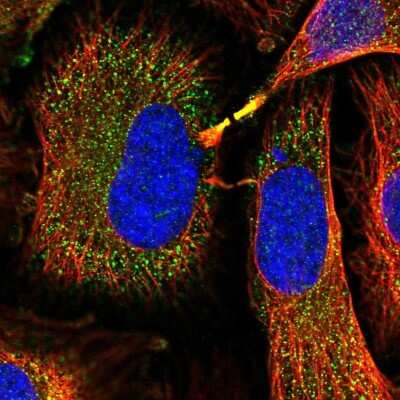 Immunocytochemistry/Immunofluorescence: Glutathione S-Transferase mu 1/GSTM1 Antibody [NBP2-46827] - Staining of human cell line HeLa shows localization to cytosol & cytokinetic bridge.