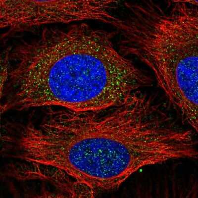 Immunocytochemistry/Immunofluorescence: Glutathione S-Transferase mu 1/GSTM1 Antibody [NBP2-46828] - Staining of human cell line HeLa shows localization to cytosol.