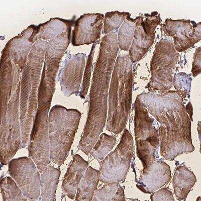 Immunohistochemistry-Paraffin: Glutathione S-Transferase mu 1/GSTM1 Antibody [NBP2-46827] - Staining of human skeletal muscle shows strong cytoplasmic positivity in myocytes.