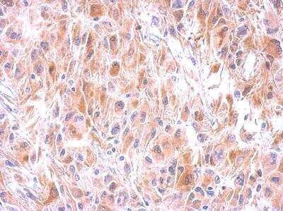 Immunohistochemistry-Paraffin: Glutathione S-Transferase mu 1/GSTM1 Antibody [NBP1-30876] -  Paraffin-embedded U37C xenograft, using antibody at 1:500 dilution.