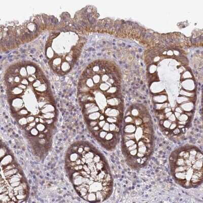 Immunohistochemistry-Paraffin: Glutathione S-Transferase mu 1/GSTM1 Antibody [NBP2-46828] - Staining of human colon shows moderate cytoplasmic positivity in glandular cells.