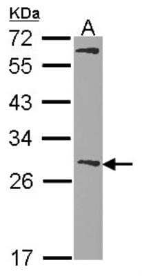 Western Blot: Glutathione S-Transferase mu 1/GSTM1 Antibody [NBP1-30876] -  Sample (30 ug of whole cell lysate) A: Hela 12% SDS PAGE Glutathione S-transferase Mu 1 antibody, antibody diluted at 1:1000.