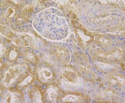 Immunohistochemistry: Glutathione S-Transferase pi 1/GSTP1 Antibody (11D5) [NBP2-76868] - Immunohistochemical analysis of paraffin-embedded rat kidney tissue using anti-GST3 antibody. The section was pre-treated using heat mediated antigen retrieval with Tris-EDTA buffer (pH 8.0-8.4) for 20 minutes.The tissues were blocked in 5% BSA for 30 minutes at room temperature, washed with ddH2O and PBS, and then probed with the antibody at 1/50 dilution, for 30 minutes at room temperature and detected using an HRP conjugated compact polymer system. DAB was used as the chrogen. Counter stained with hematoxylin and mounted with DPX.