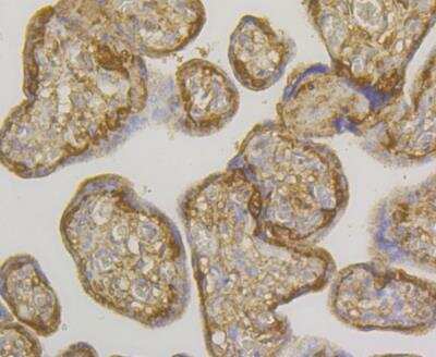 Immunohistochemistry: Glutathione S-Transferase pi 1/GSTP1 Antibody (11D5) [NBP2-76868] - Immunohistochemical analysis of paraffin-embedded human placenta tissue using anti-GST3 antibody. The section was pre-treated using heat mediated antigen retrieval with Tris-EDTA buffer (pH 8.0-8.4) for 20 minutes.The tissues were blocked in 5% BSA for 30 minutes at room temperature, washed with ddH2O and PBS, and then probed with the antibody at 1/200 dilution, for 30 minutes at room temperature and detected using an HRP conjugated compact polymer system. DAB was used as the chrogen. Counter stained with hematoxylin and mounted with DPX.