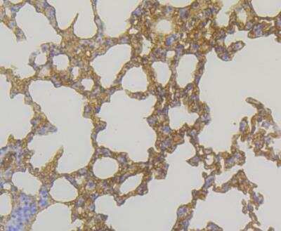 Immunohistochemistry: Glutathione S-Transferase pi 1/GSTP1 Antibody (11D5) [NBP2-76868] - Immunohistochemical analysis of paraffin-embedded mouse lung tissue using anti-GST3 antibody. The section was pre-treated using heat mediated antigen retrieval with Tris-EDTA buffer (pH 8.0-8.4) for 20 minutes.The tissues were blocked in 5% BSA for 30 minutes at room temperature, washed with ddH2O and PBS, and then probed with the antibody at 1/200 dilution, for 30 minutes at room temperature and detected using an HRP conjugated compact polymer system. DAB was used as the chrogen. Counter stained with hematoxylin and mounted with DPX.