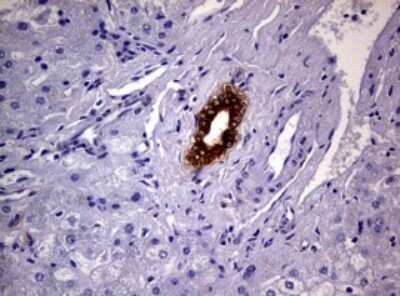 Immunohistochemistry: Glutathione S-Transferase pi 1/GSTP1 Antibody (OTI4B6) - Azide and BSA Free [NBP2-70857] - Analysis of Human liver tissue. (Heat-induced epitope retrieval by 10mM citric buffer, pH6.0, 120C for 3min)